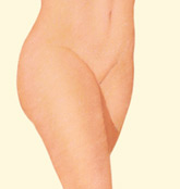A woman with smaller thighs after undergoing thigh liposuction